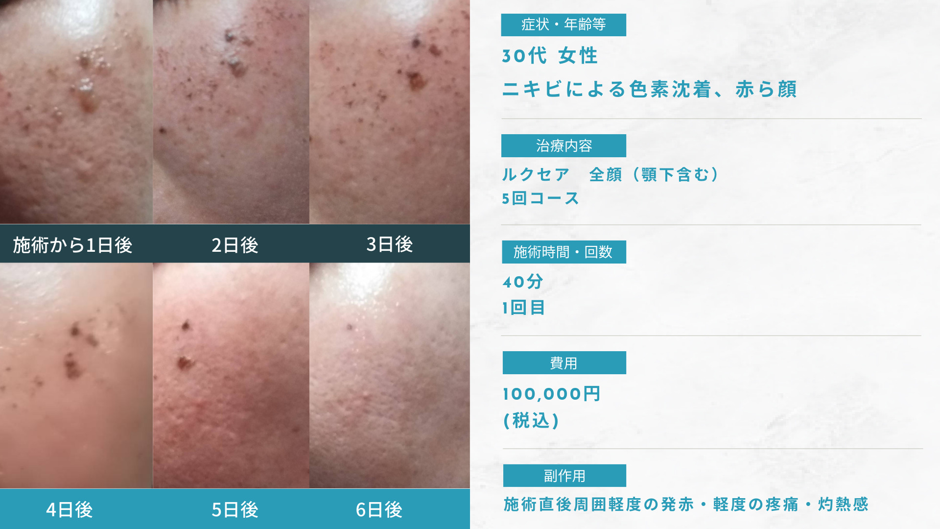 三鷹ヒロクリニックの症例写真
