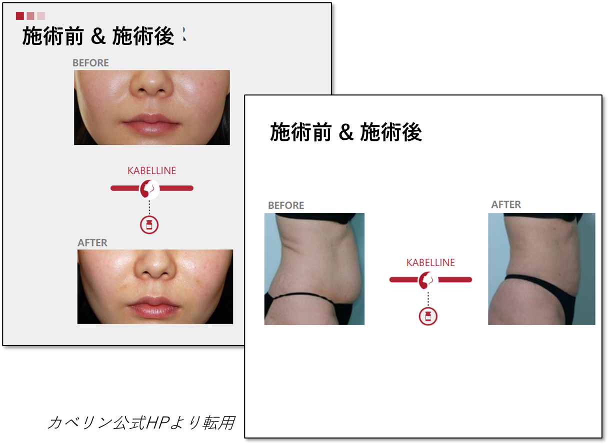 case-fhoto