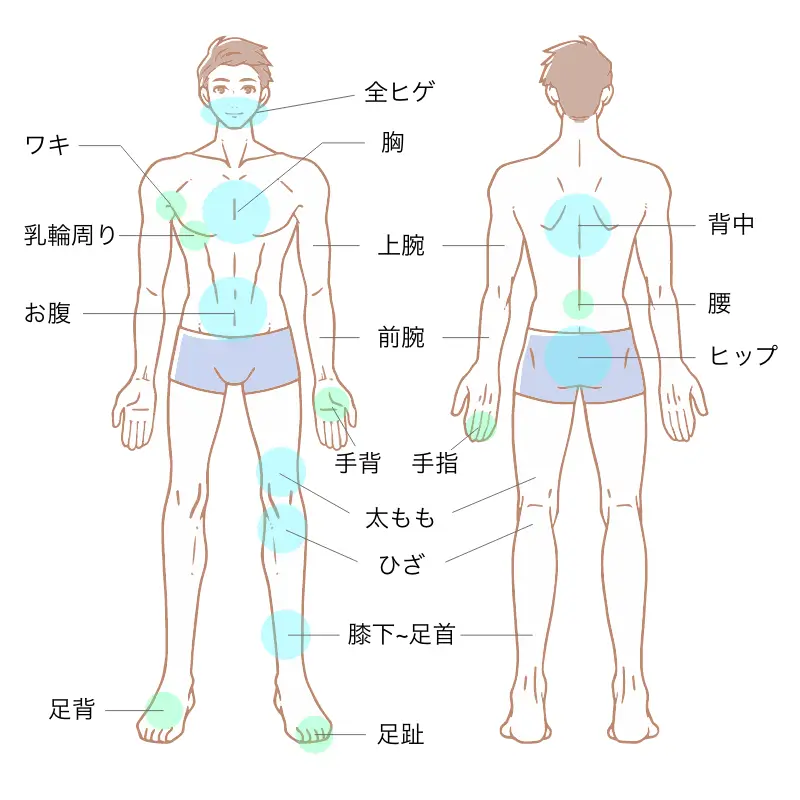 医療脱毛 施術範囲（男性・全身＋全ヒゲ）：全ヒゲ・胸・上腕・前腕・手背・手指・ワキ・乳輪周り・お腹・太もも・ひざ・膝下〜足首・足背・足趾・背中・腰・ヒップ