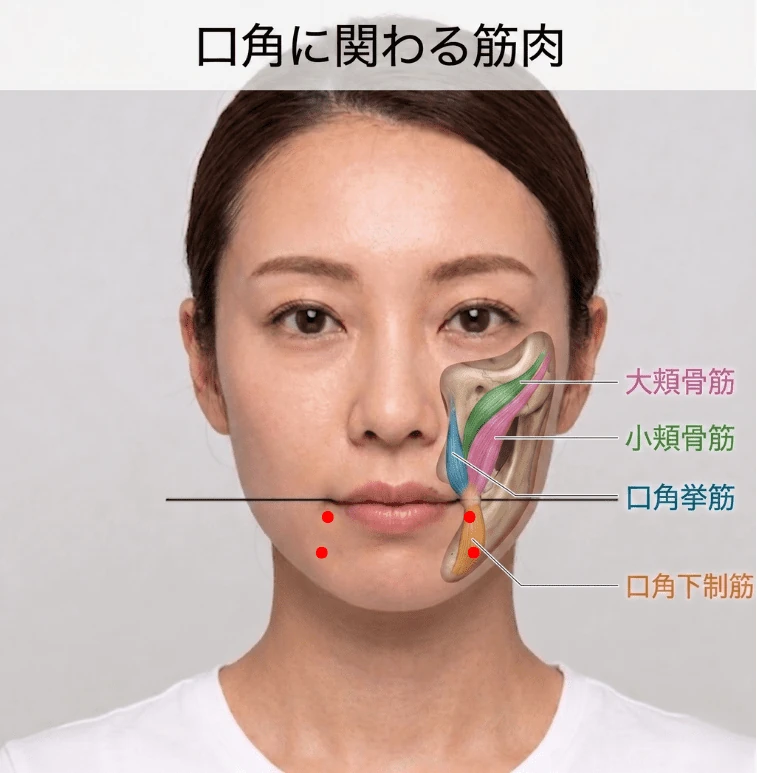 口角に関わる筋肉（大頬骨筋・小頬骨筋・口角挙筋・口角下制筋）を示した図